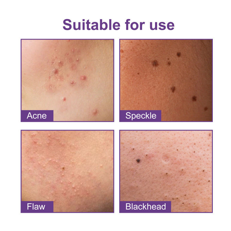 Anti-acne Waterproof Breathable Repair Acne Skin Pattern Acne Patch